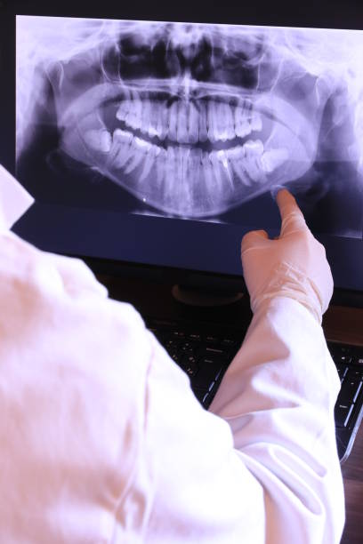Best Emergency Wisdom Teeth Removal in Sanford, CO