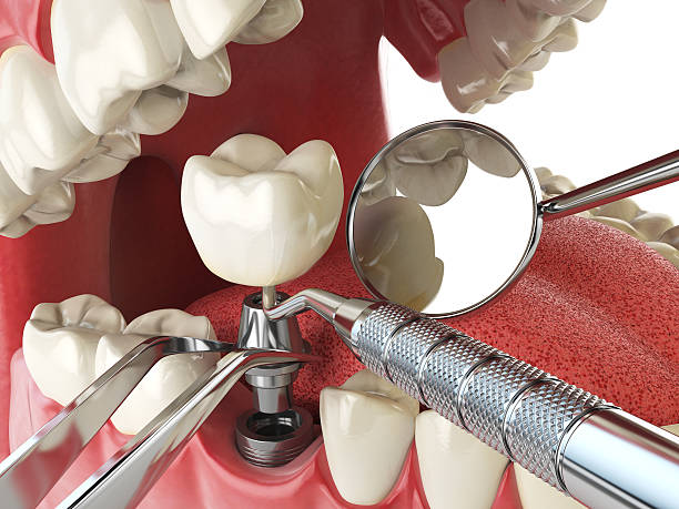 Best Emergency Denture Repair in Sanford, CO